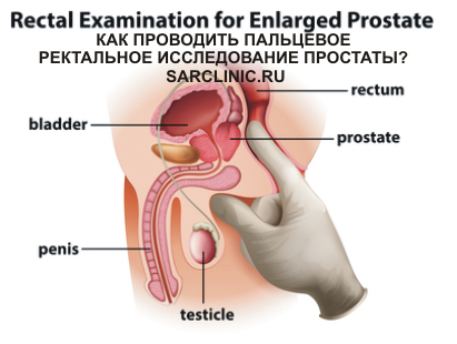 Как жить с хр простатитом